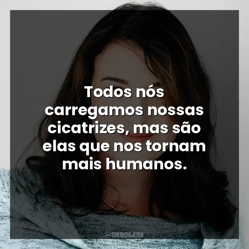Todos nós carregamos nossas cicatrizes, mas são elas que nos tornam mais humanos.